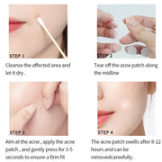 Loomi Patches | Hydrocolloid Patch | Entferne Pickel in Stunden - Acne Patch Nika